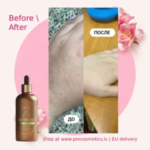 Lolum neem oil before after Chogan buy online