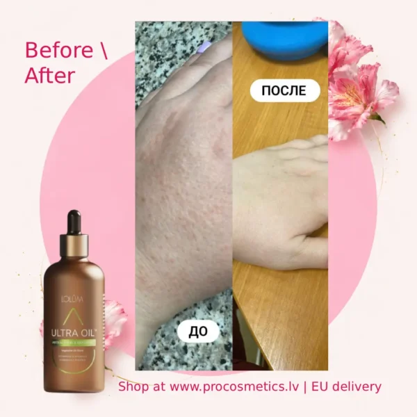 Lolum neem oil before after Chogan buy online