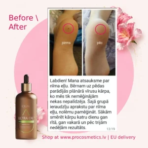 Lolum neem oil before after Chogan buy online