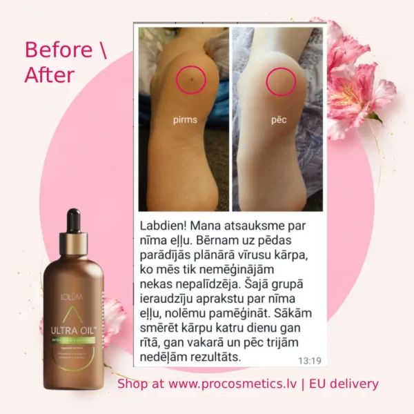 Lolum neem oil before after Chogan buy online