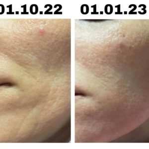 Peptilux pirms un pec