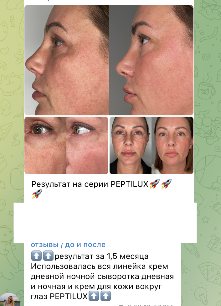 Peptides against wrinkles – how do they work and which products to choose? 1 Rezultati no peptilux krema 1 ProCosmetics.lv Chogan products shop
